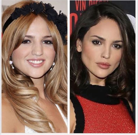 eiza gonzález lips before and after|More.